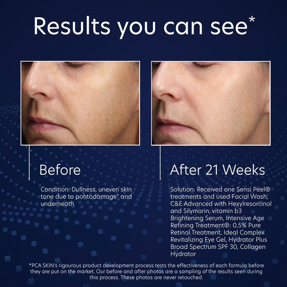PCA SKIN Vitamin B3 Brightening Serum box packaging highlights premium brightening care.