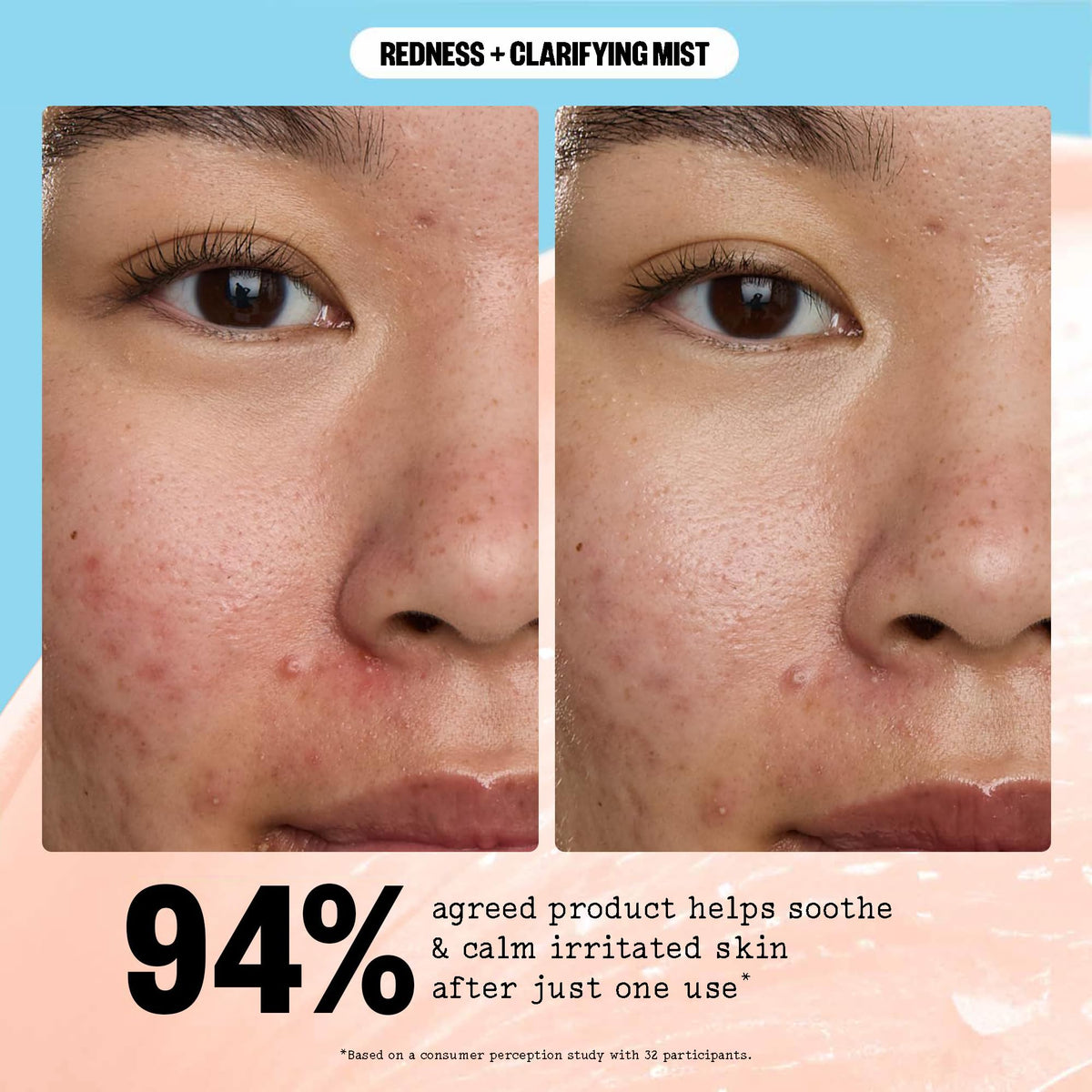 PEACE OUT Redness + Clarifying Mist application demonstrates quick skin refresh.
