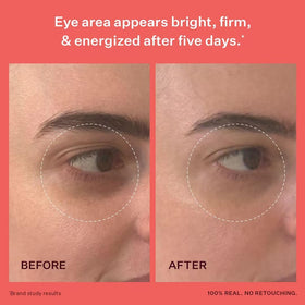 Peach & Lily diglucosyl gallic acid formula brightens under-eye area