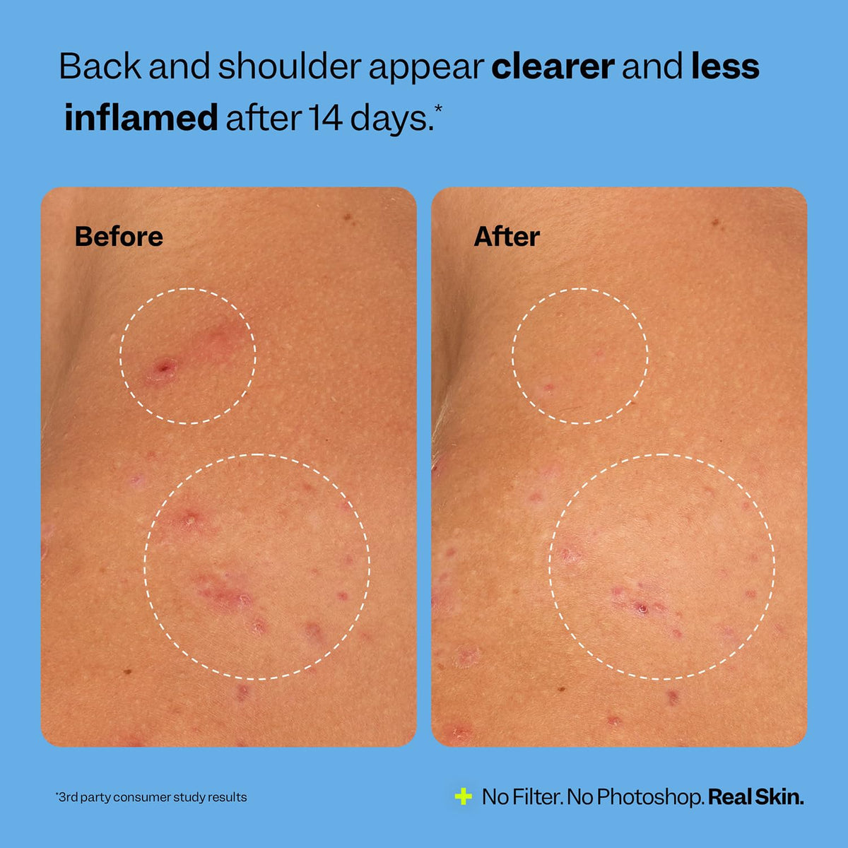 Peach Slices Breakout Banisher beside clean ingredients ideal for sensitive skin