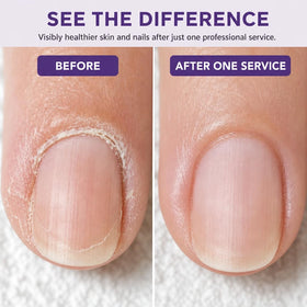 Pedicure prep with PRO NAIL lotion enhancing prep and conditioning