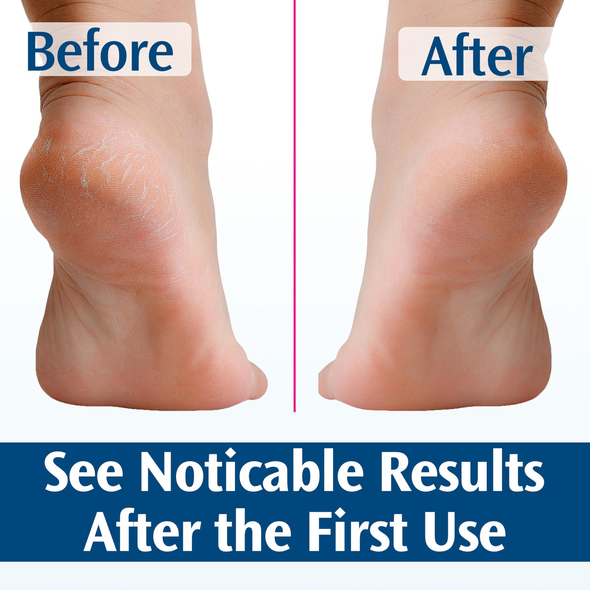 Packaging displays a doctor-recommended label for Pedifix foot care