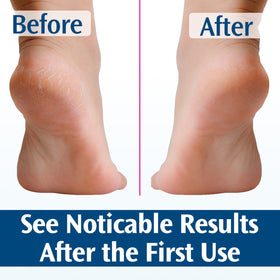 Packaging displays a doctor-recommended label for Pedifix foot care