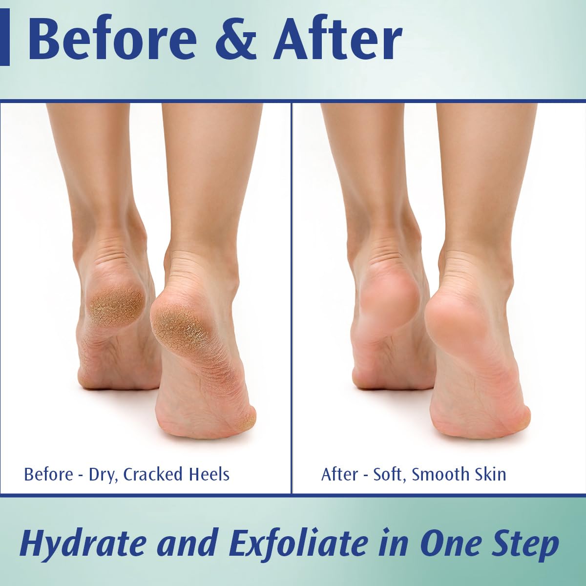 Pedifix extra-strength foot cream demonstrates rich texture for dry, cracked heels at home