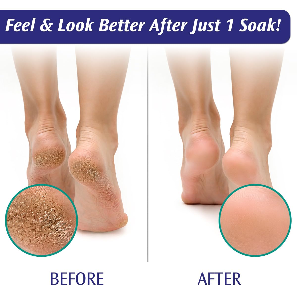 Pedifix single-use packets offer convenient travel-ready foot care.