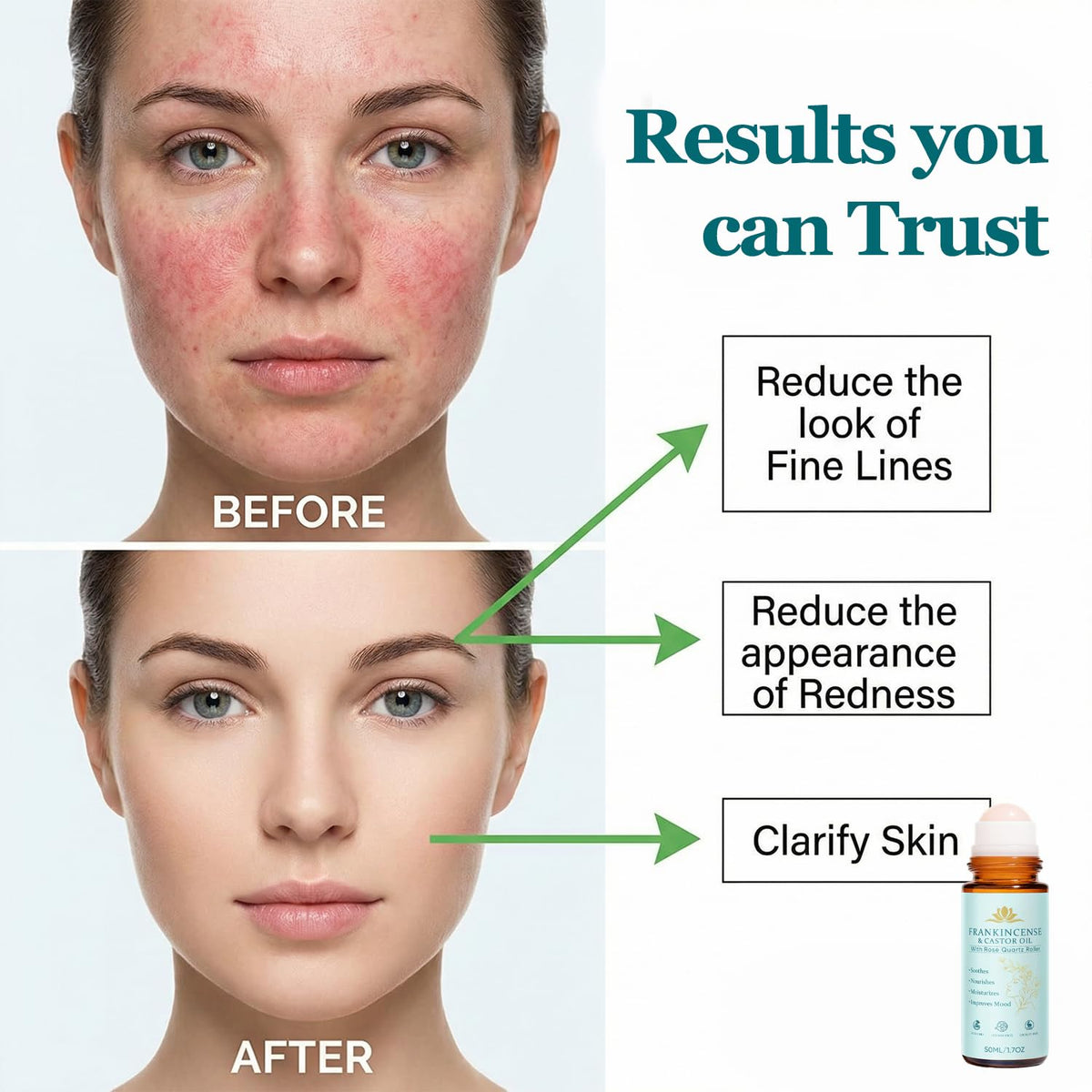 Peehss under-eye roll-on for gentle care and calm skin