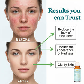 Peehss under-eye roll-on for gentle care and calm skin