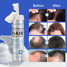 Peesnb minoxidil foam application on scalp demonstrates convenient, fast-absorb formula