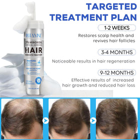 Peesnb minoxidil foam dispensing closeup highlights precise, mess-free application