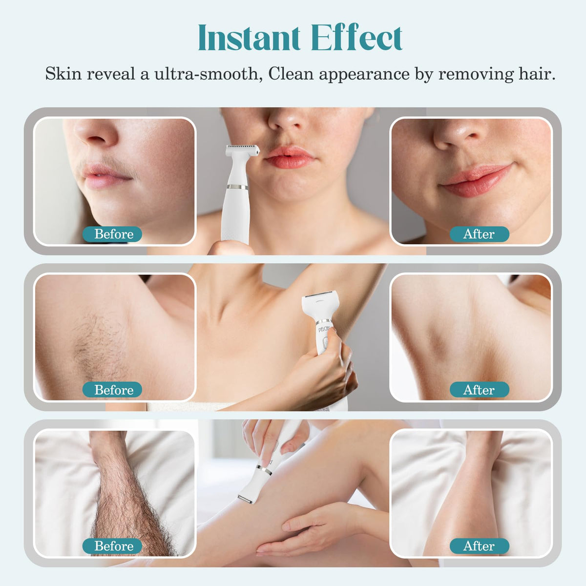 PELCA S Hypoallergenic blades reduce irritation during sensitive skin grooming.