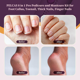 PEL-CAS cordless nail drill with LED light highlights precise filing on thick nails.