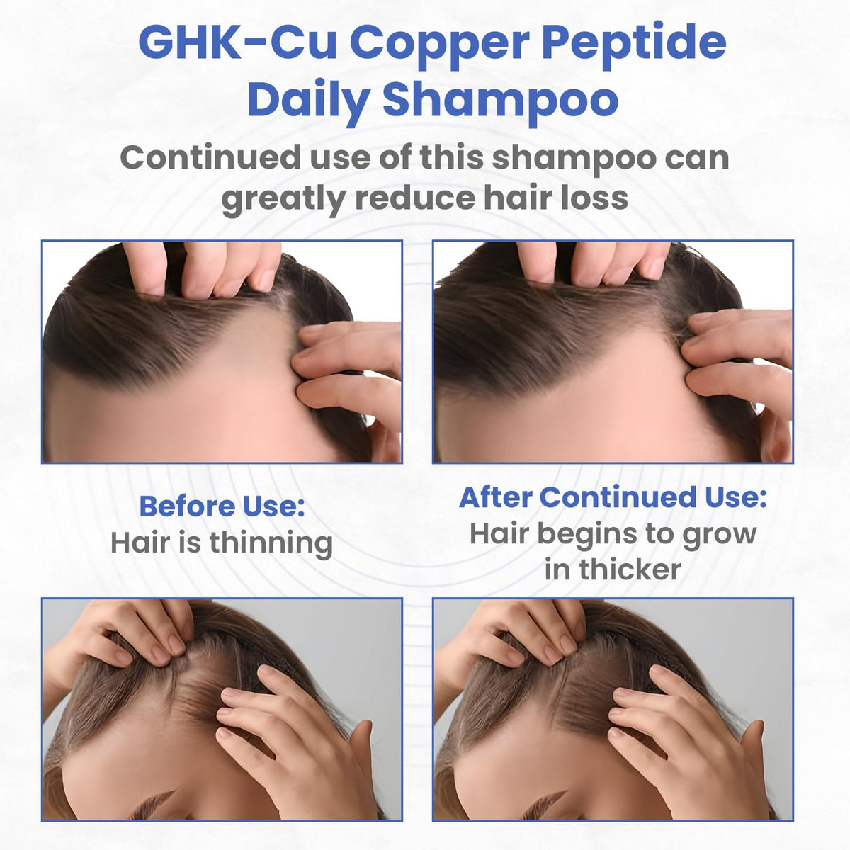 PeptideLabz label emphasizing GHK-Cu formula for scalp care