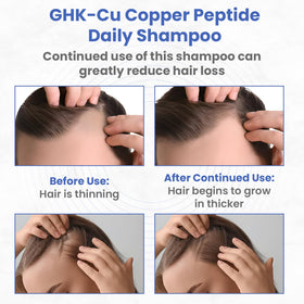 PeptideLabz label emphasizing GHK-Cu formula for scalp care