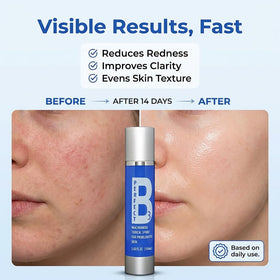 Perfect B3 Niacinamide Spray used over makeup for long wear