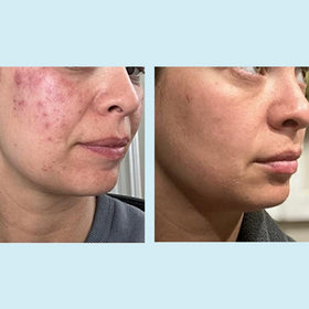 Soft glow after use with refreshed skin appearance.