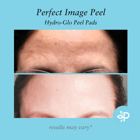 Perfect Image Hydro-Glo Peel Pads application swatch demonstrates even-toned skin.