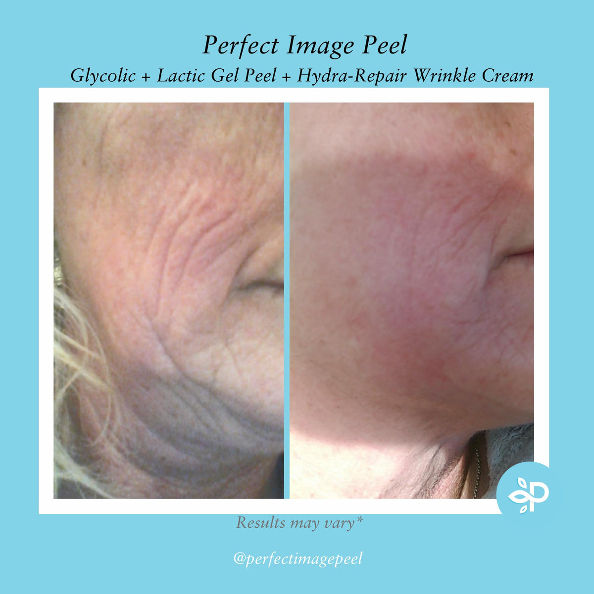Perfect Image Retinol Green Tea ingredients visual for skin care