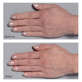 Perricone MD Cold Plasma Plus+ Hand Therapy application on hand demonstrating quick absorption.