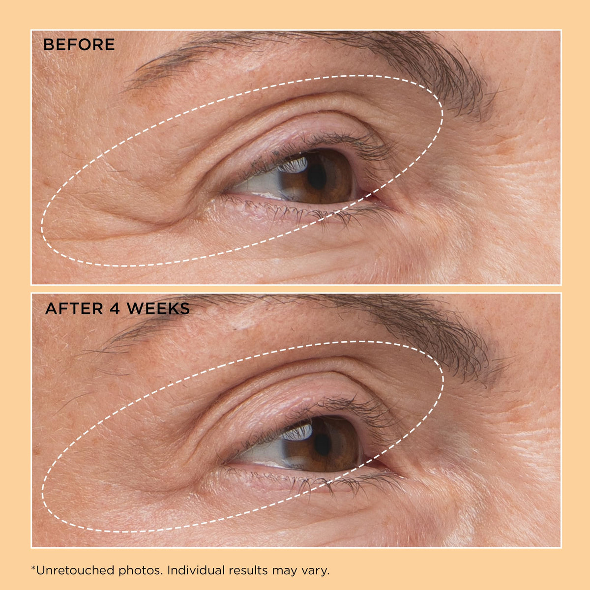 Perricone MD Eyelid Lift Serum swatch on skin showing easy layering.