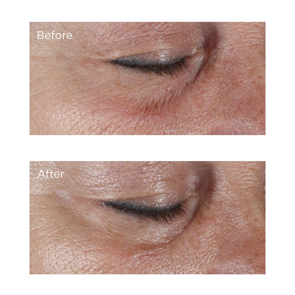 Perricone MD hypoallergenic firming eye cream application area brightening eye contour.