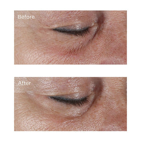 Perricone MD hypoallergenic firming eye cream application area brightening eye contour.
