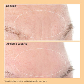 Perricone MD Neuropeptide serum on crepiness areas with a gentle glide