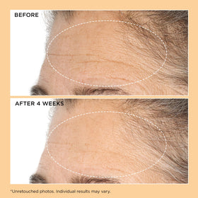 Perricone MD Neuropeptide serum addressing discoloration near the mouth area