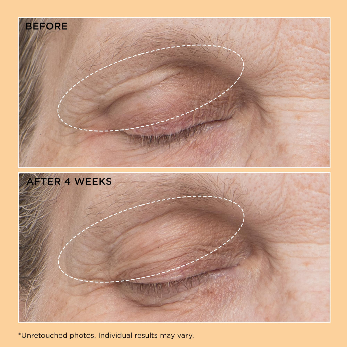 Texture swirl of Perricone MD Neuropeptide Eyelid Lift Serum demonstrates lightweight, fast-absorbing formula.