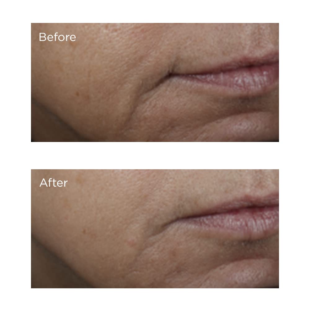 Perricone MD Vitamin C Ester Brightening Amine Face Lift packaging emphasizes copper hydration.