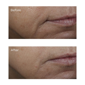 Perricone MD Vitamin C Ester Brightening Amine Face Lift packaging emphasizes copper hydration.