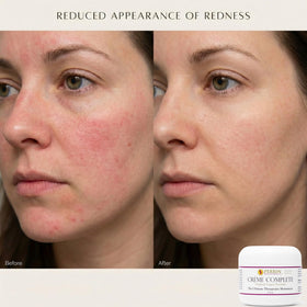 Perrin Naturals Creme Complete application on hands demonstrates easy spread.