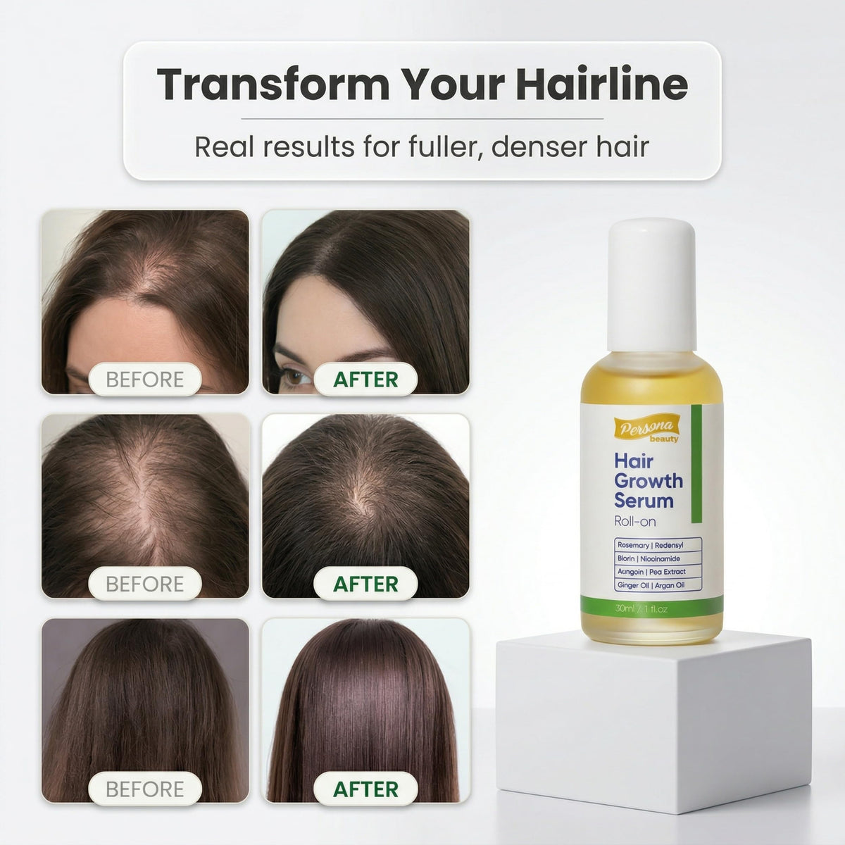 Persona Beauty Hair Growth Serum Roll-On dispenses directly at the root for targeted coverage.