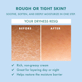 Petal Fresh Skin ResQ Hello Hydration jar close-up for sensitive skin comfort