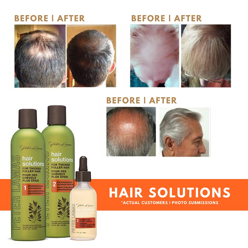 Scalp-application shot showing potential scalp care daily use