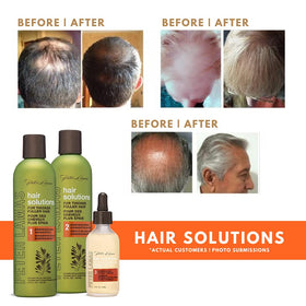Scalp-application shot showing potential scalp care daily use