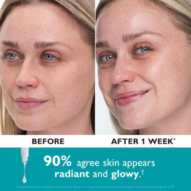 Peter Thomas Roth Collagen Skinjection serum on skin showing a plump, hydrated appearance