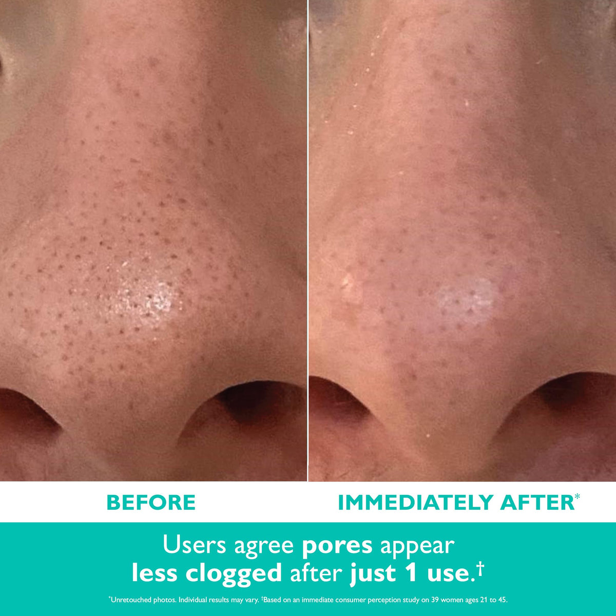Peter Thomas Roth Even Smoother application portrait demonstrates gentle cleansing and pore purification potential.