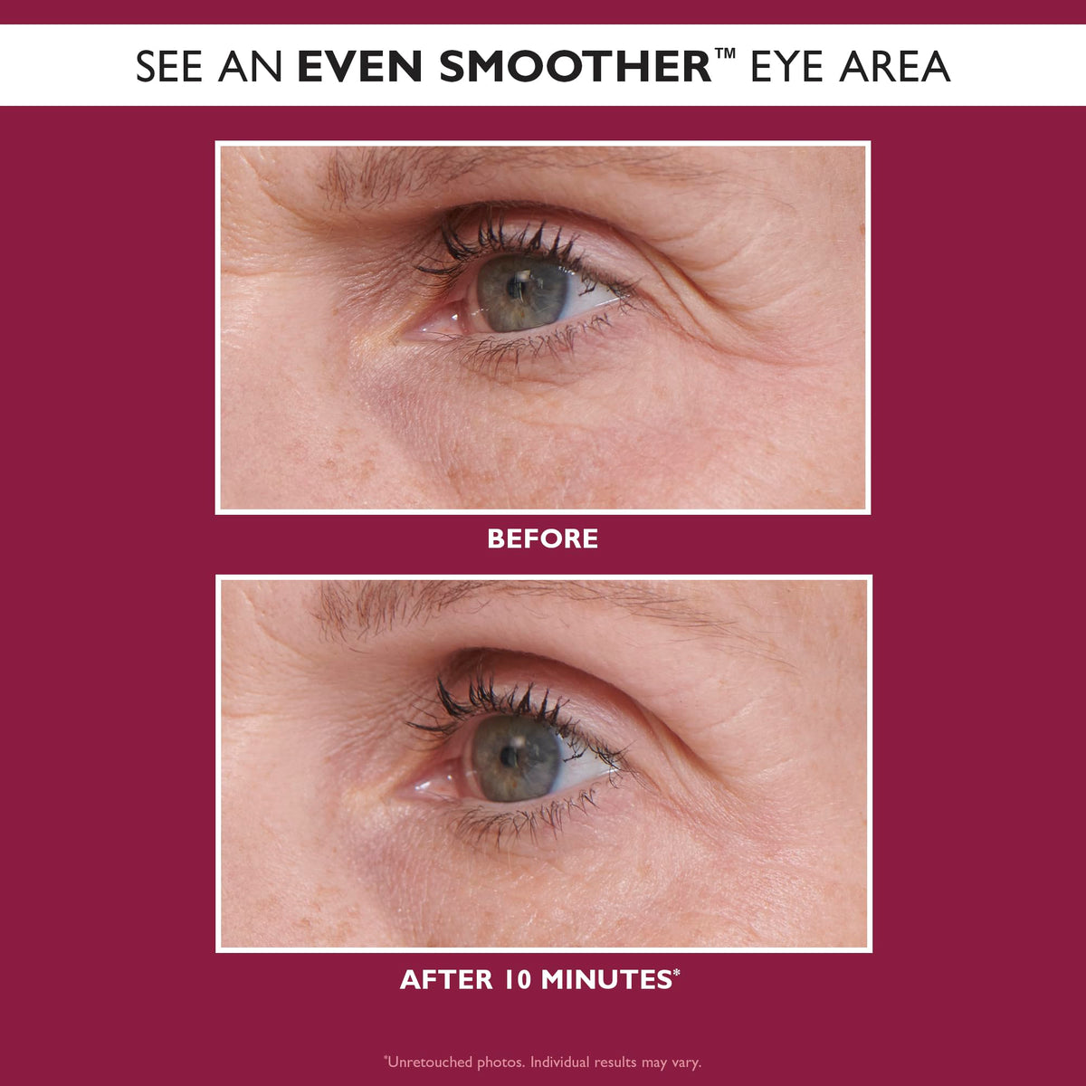 Niacinamide and Revital-Eyes shown as part of Peter Thomas Roth patch formula for brightness