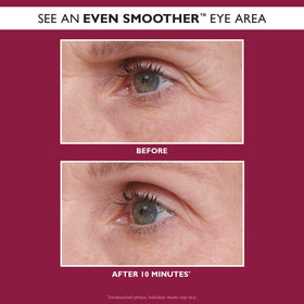 Niacinamide and Revital-Eyes shown as part of Peter Thomas Roth patch formula for brightness