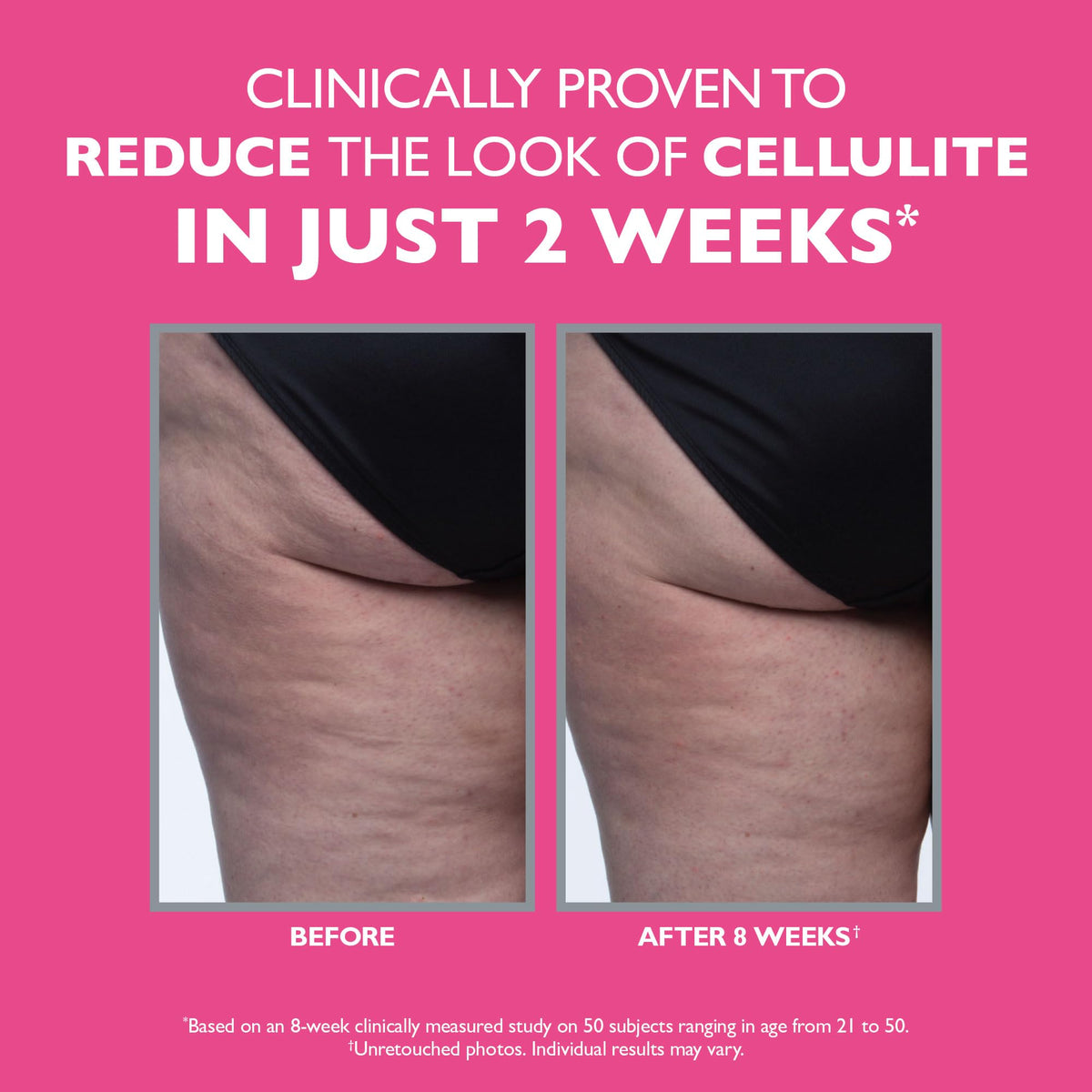 Applying Peter Thomas Roth FIRMx Tight & Toned on thighs for firmer look.