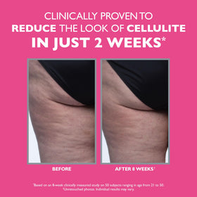 Applying Peter Thomas Roth FIRMx Tight & Toned on thighs for firmer look.