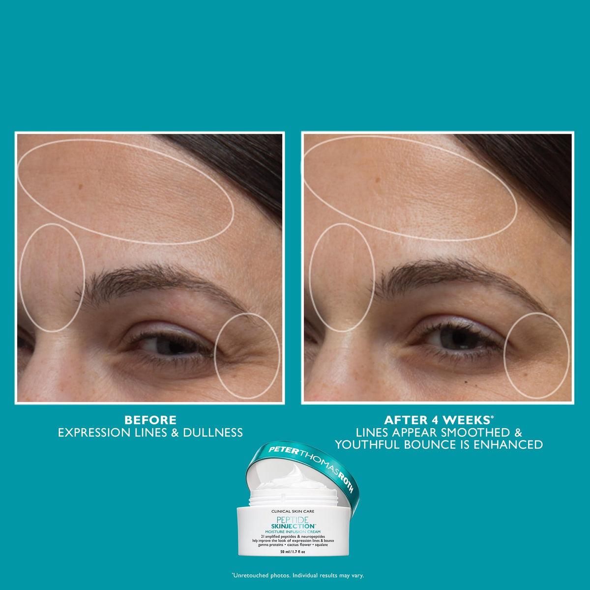 Peter Thomas Roth Moisture Infusion Cream close up emphasizing hydration and plumpness