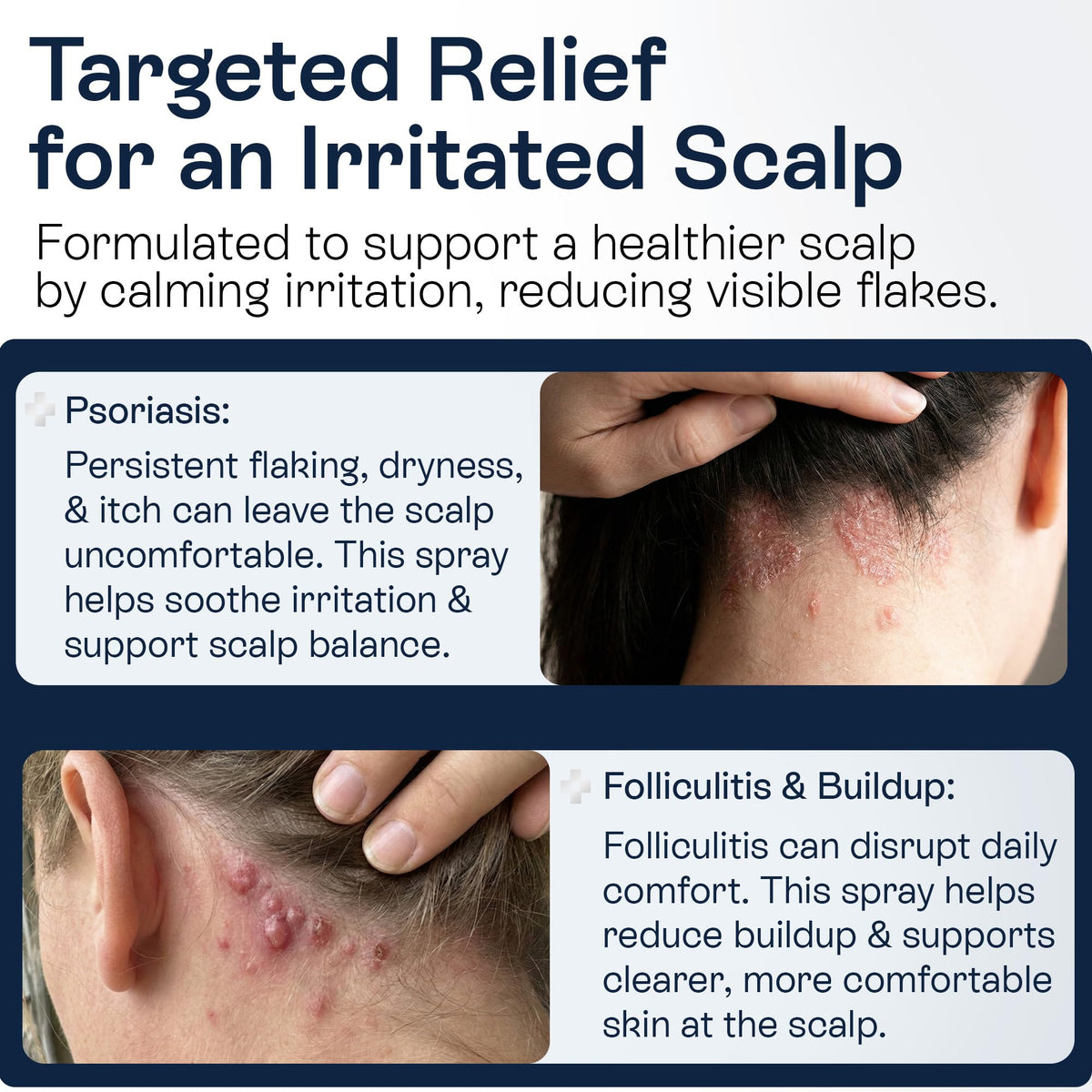 Pharmlitalia 3% salicylic acid formula applied to the scalp