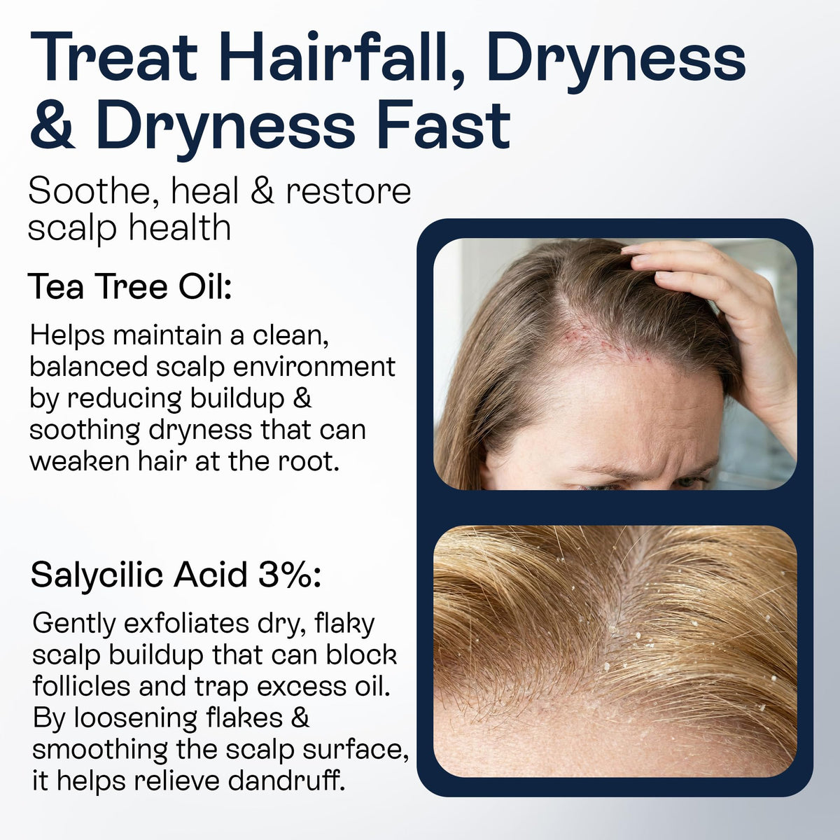 Pharmlitalia balanced scalp environment shown with spray