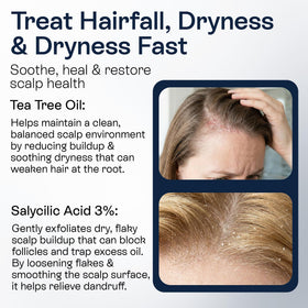 Pharmlitalia balanced scalp environment shown with spray