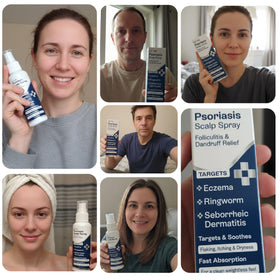 Pharmlitalia eczema and dryness care on scalp
