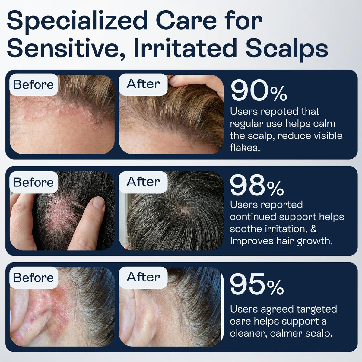 Pharmlitalia support for folliculitis and seborrheic dermatitis