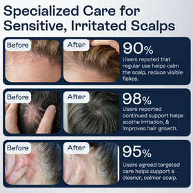 Pharmlitalia support for folliculitis and seborrheic dermatitis