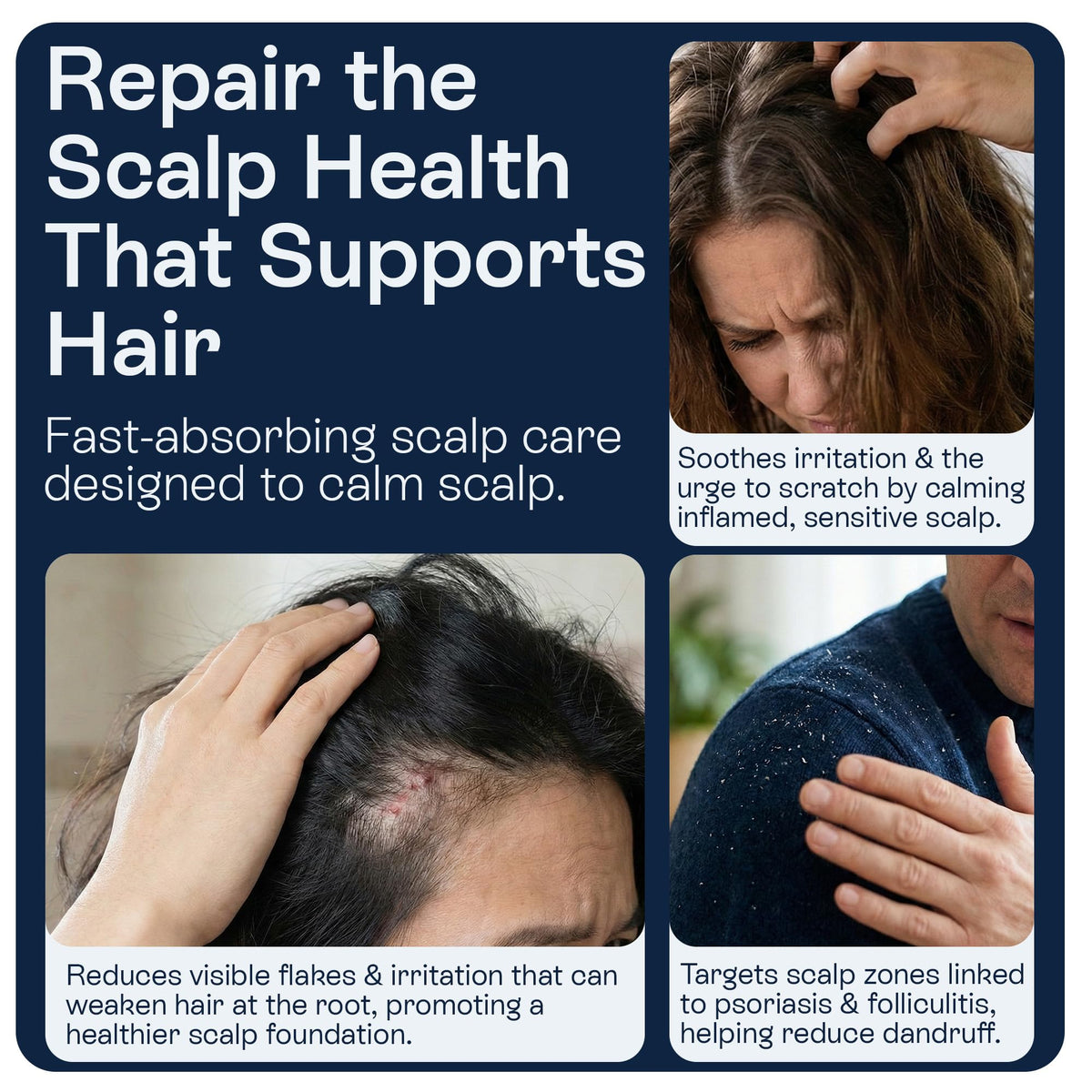 Pharmlitalia itching relief on scalp with targeted spray