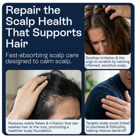 Pharmlitalia itching relief on scalp with targeted spray